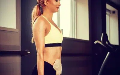 Exercising with a Stoma