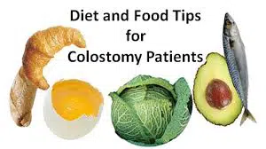 Stoma nutrition support